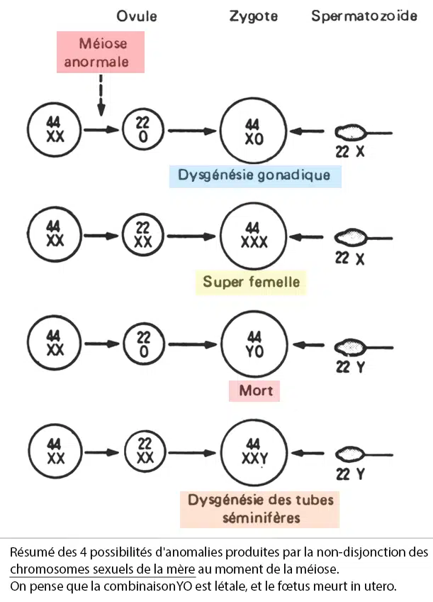 Anomalies de non-disjonction des chromosomes sexuels — syndrome de Turner et Klinefelter