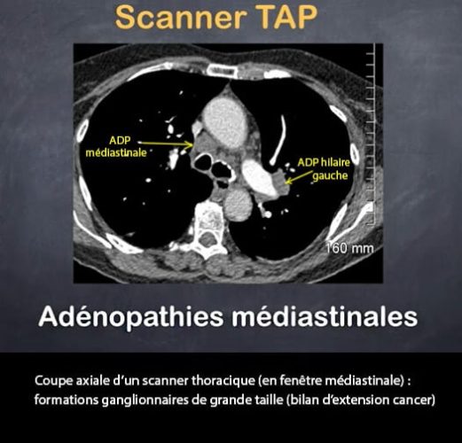 scanner TAP