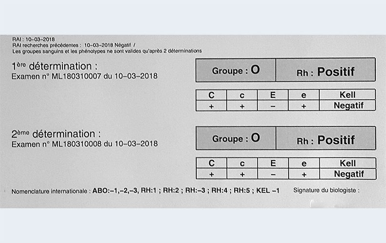 Analyses goss 2 GS 2