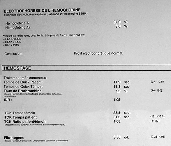 Analyses goss 3 electrophorese TP