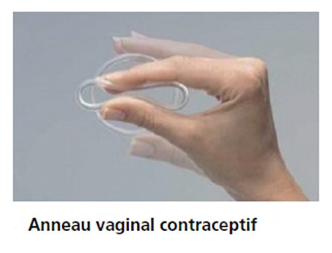 Anneau vaginal contraceptif — NuvaRing pose et retrait 1