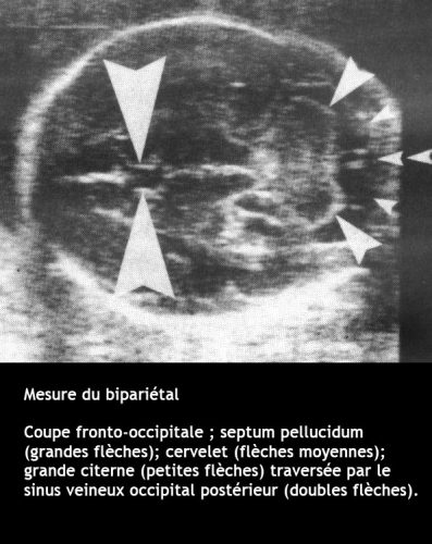 BIP_mesure