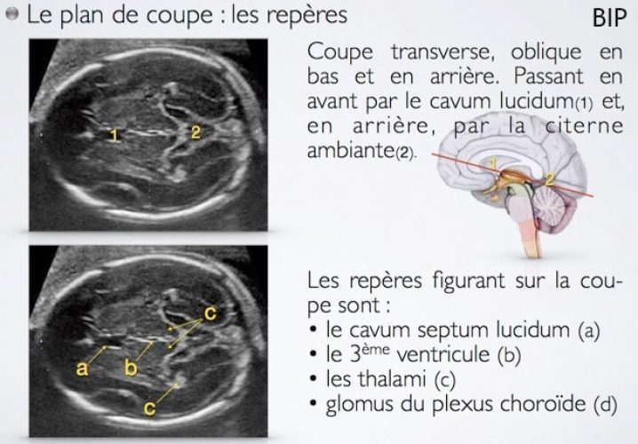 BIP_plans de coupe