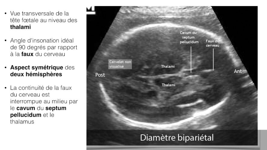 BIP_repères