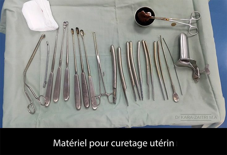 curetage de la cavité utérine
