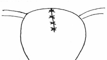 Bret-palmer 5