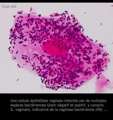 Clue cell
