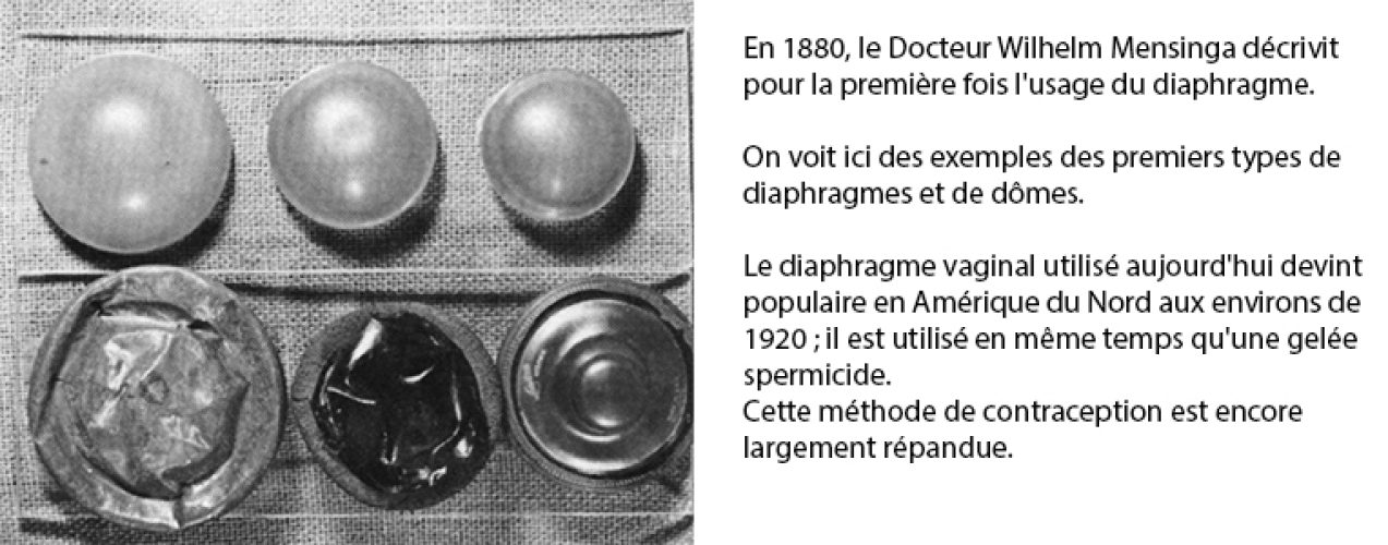 Contraception 5
