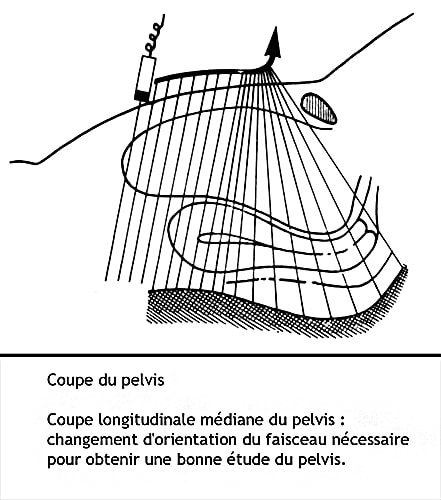 Coupe pelvis 1