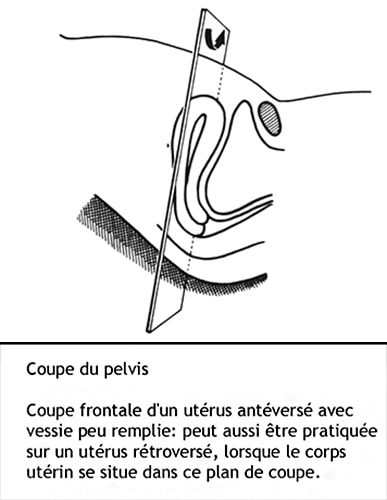 Coupe pelvis 2