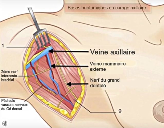 Curage axillaire_bases anatomiques