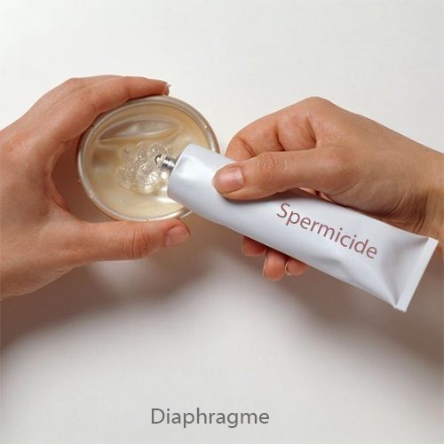 Diaphragme contraceptif — pose et utilisation contraceptif barrière 2