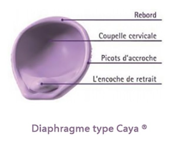 Diaphragme contraceptif — pose et utilisation contraceptif barrière 3