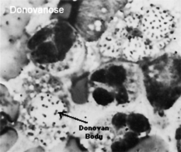 Donovanose 8