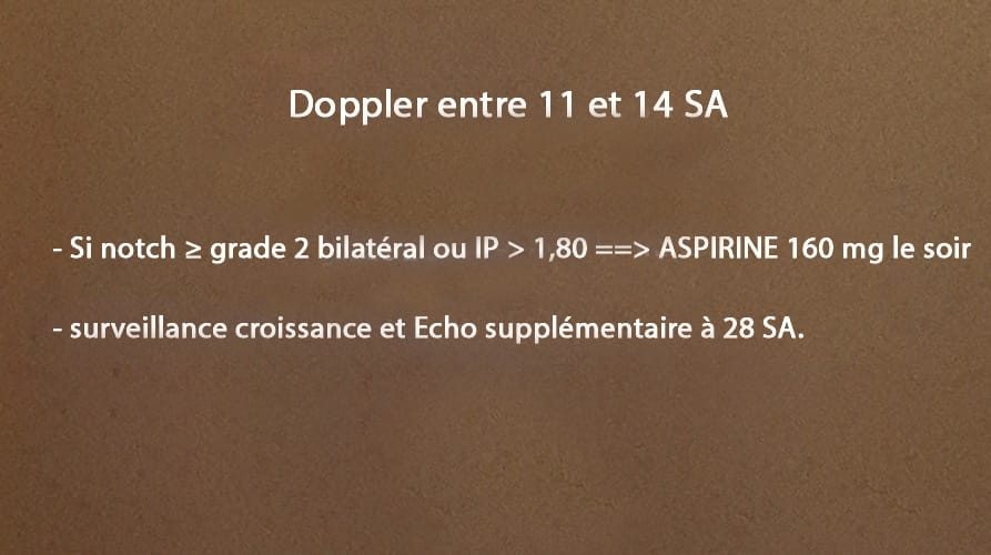Doppler art_uterine 7