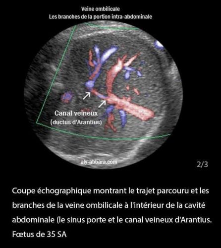 Doppler ductus 3