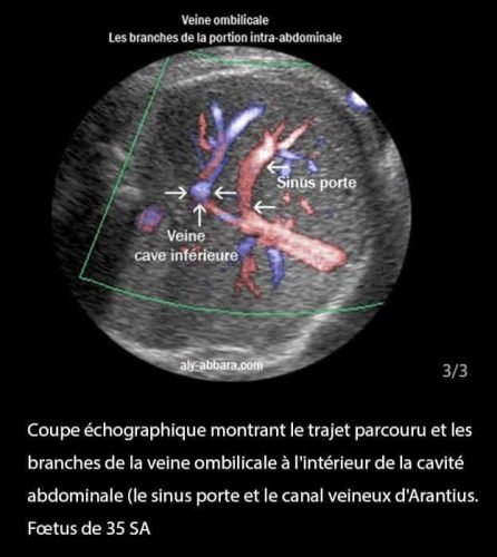 Doppler ductus 4