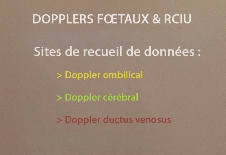 Doppler_rciu 2