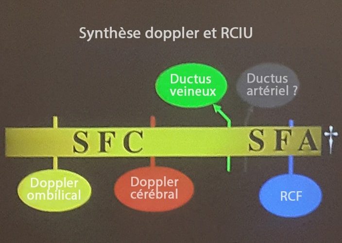 Doppler_rciu