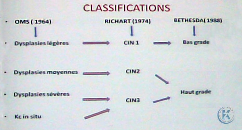 Dysplasies du col utérin — classification lésions précancéreuses