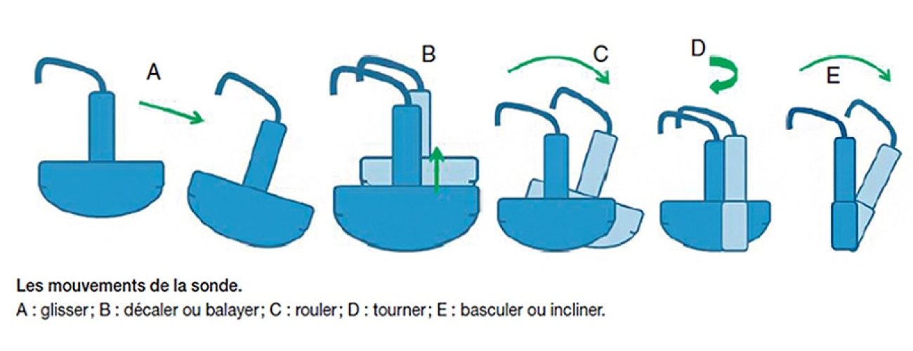 Mouvements de la sonde échographique — technique balayage rotation angulation
