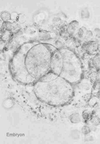 Embryon — développement embryonnaire précoce stades de segmentation