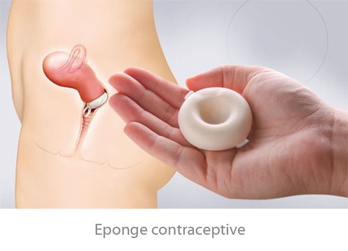 éponges spermicides