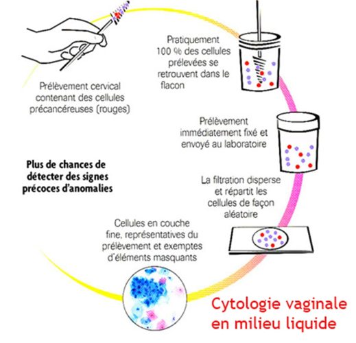 Frottis cervico-vaginal