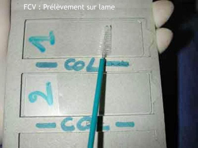 Frottis cervico-vaginal 8