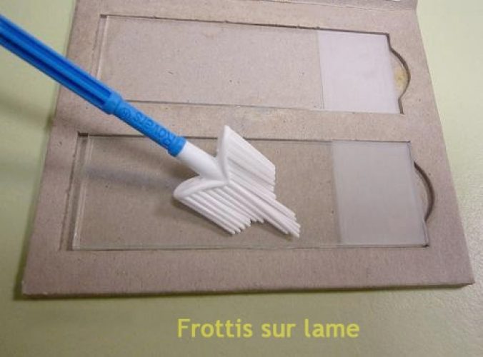 Frottis cervico-vaginal 9