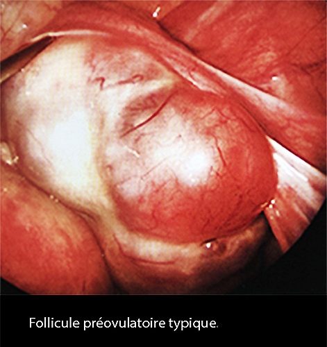 Follicule_coelio