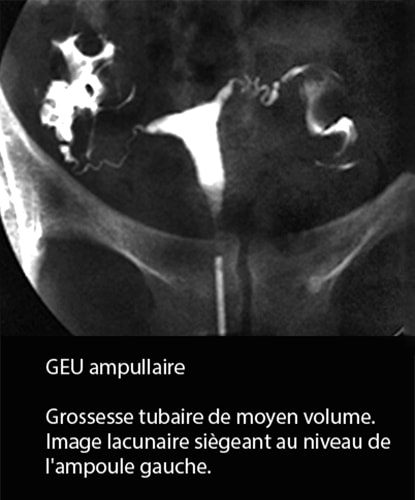 GEU 1