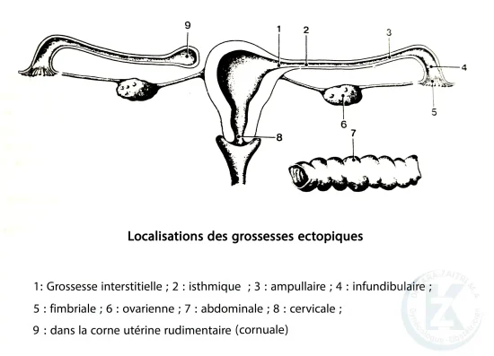 GEU_localisation