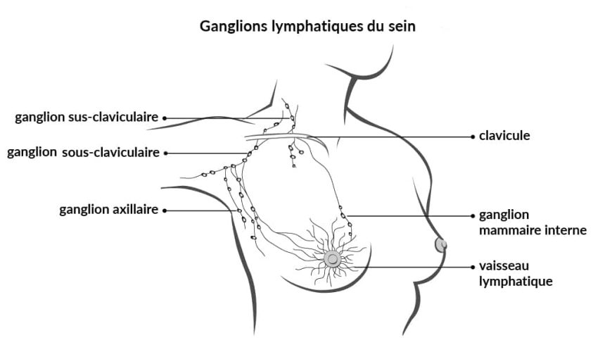 Ganglions lymphatiques du sein