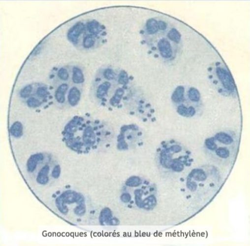 Gonocoque 1