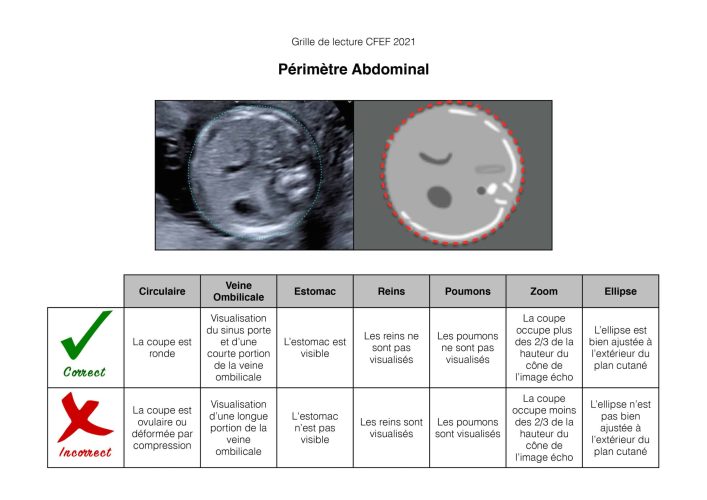 Grille biométrie fœtale périmètre abdominal CFEF 2021 — courbes de référence