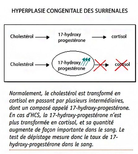 Qu’Est-Ce Que L’Hyperplasie Bilatérale Des Surrénales – XPTWS