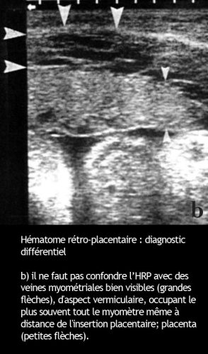 HRP_diagnostic diff