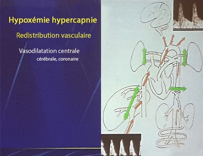 Hypoxie_vasodilatation
