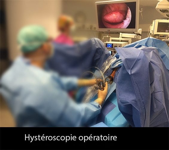 Hystéroscopie — image endoscopique cavité utérine 2