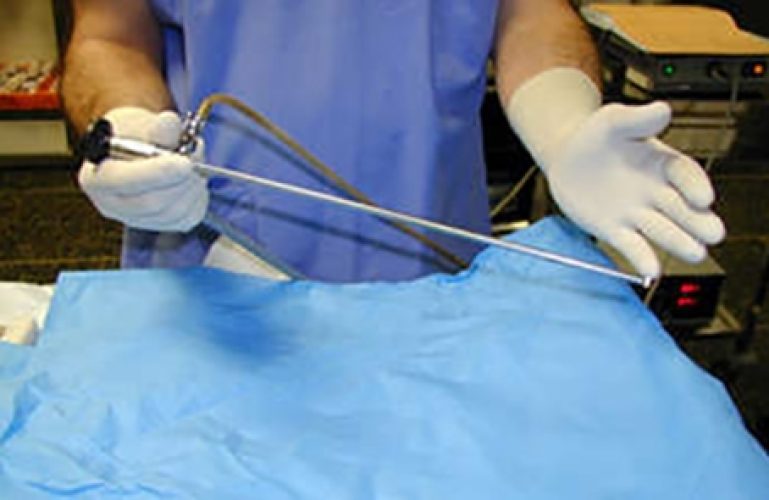 Hystéroscopie — image endoscopique cavité utérine 3