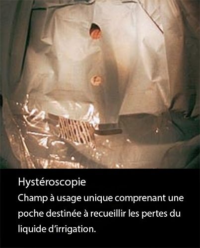 Hystéroscopie — image endoscopique cavité utérine 5