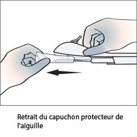 Implant contraceptif sous-cutané — pose et retrait Nexplanon 4