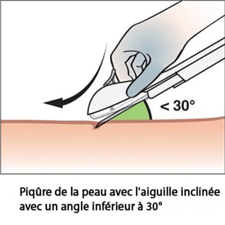 Implant contraceptif sous-cutané — pose et retrait Nexplanon 6
