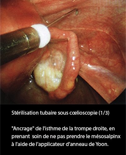 LDT_coelio 3