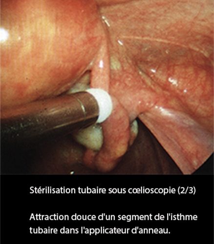 LDT_coelio 4