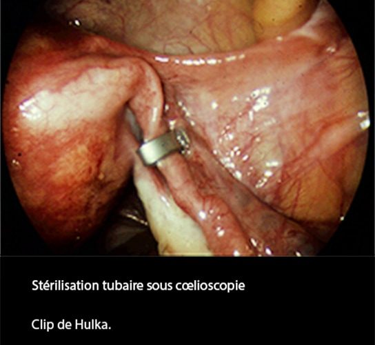 LDT_coelio 7