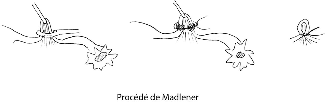 LDT_madlener