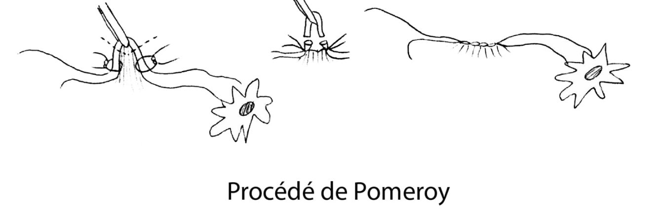 LDT_pomeroy