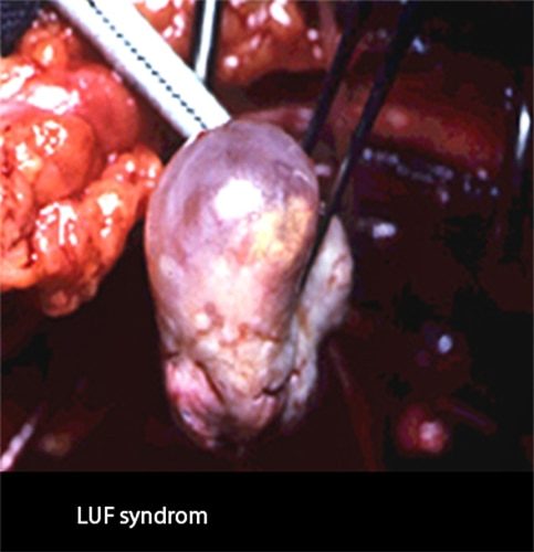LUF-SD 2